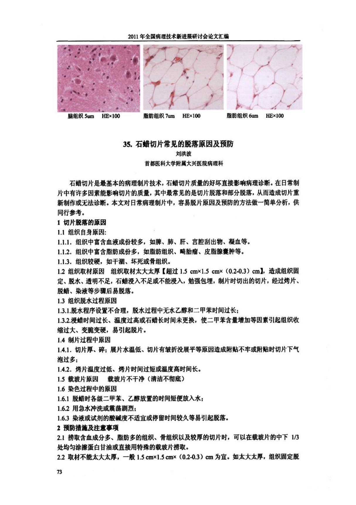 石蜡切片常见的脱落原因及预防