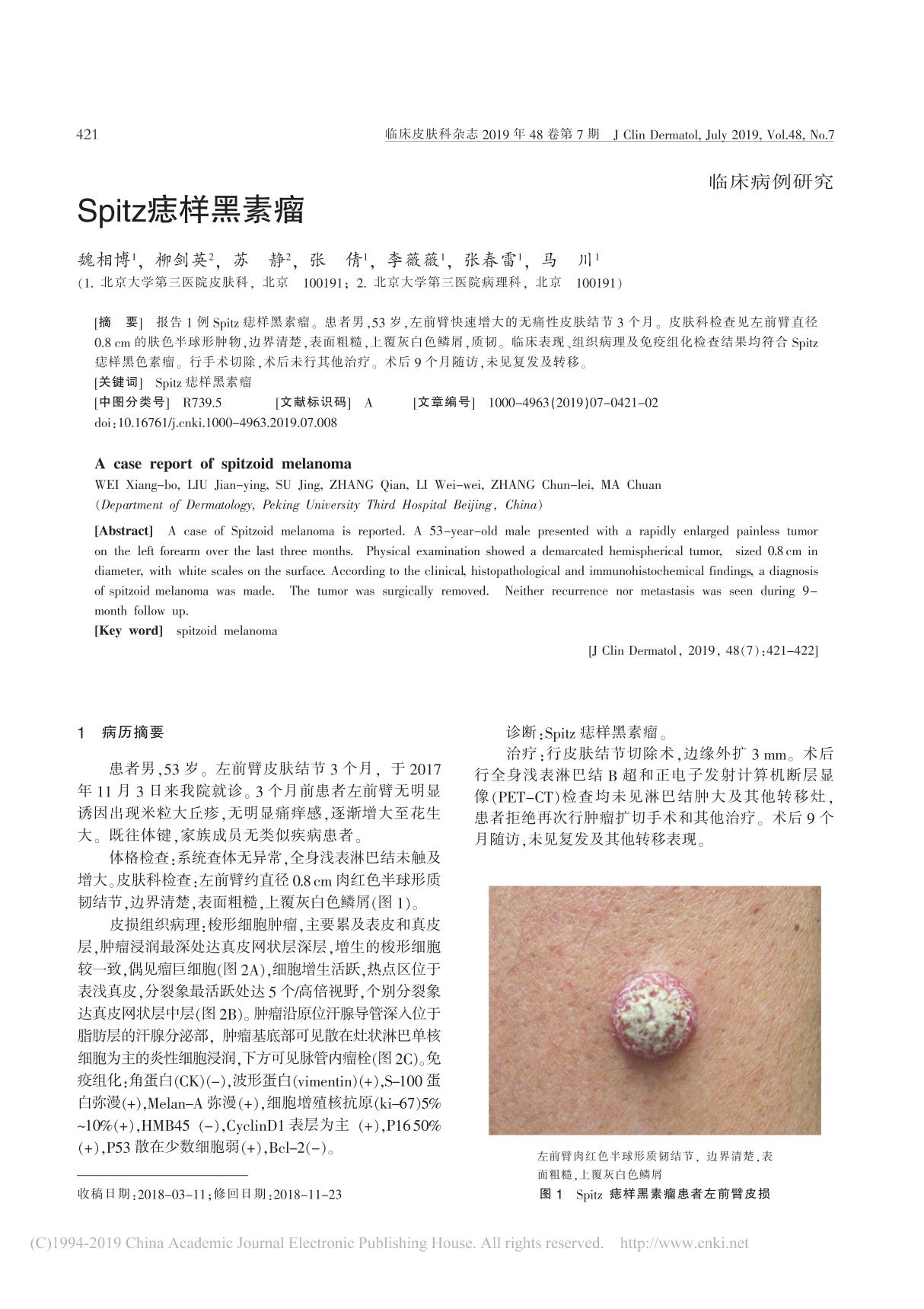 Spitz痣样黑素瘤 魏相博