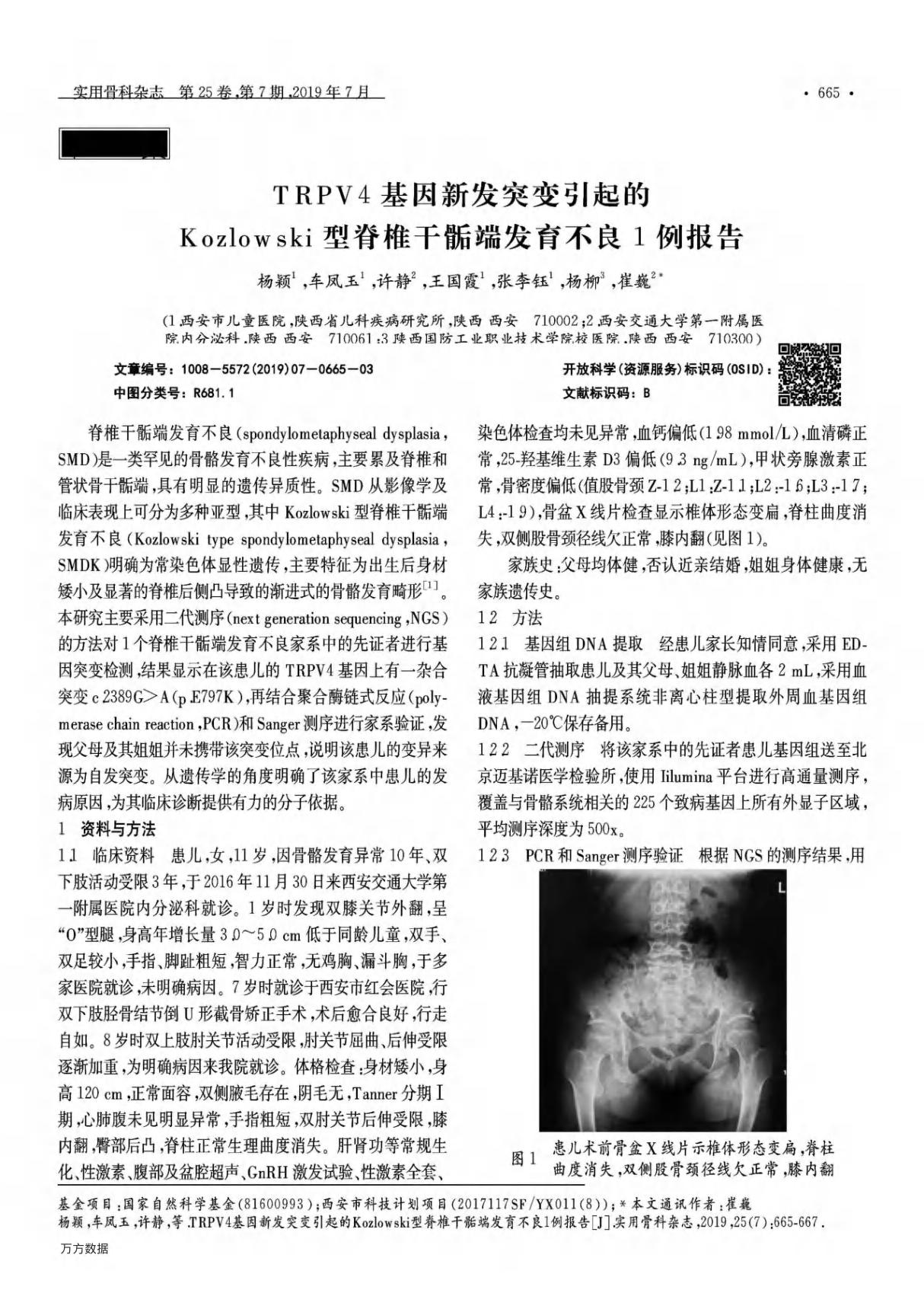 TRPV4基因新发突变引起的Kozlowski型脊椎干骺端发育不良1例报告