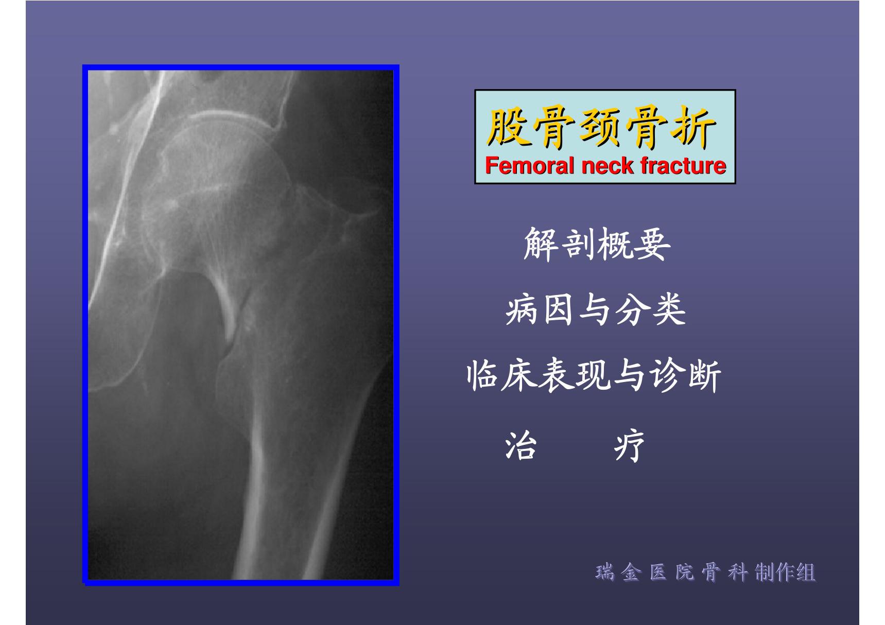 股骨颈骨折ppt 〖精品课件〗