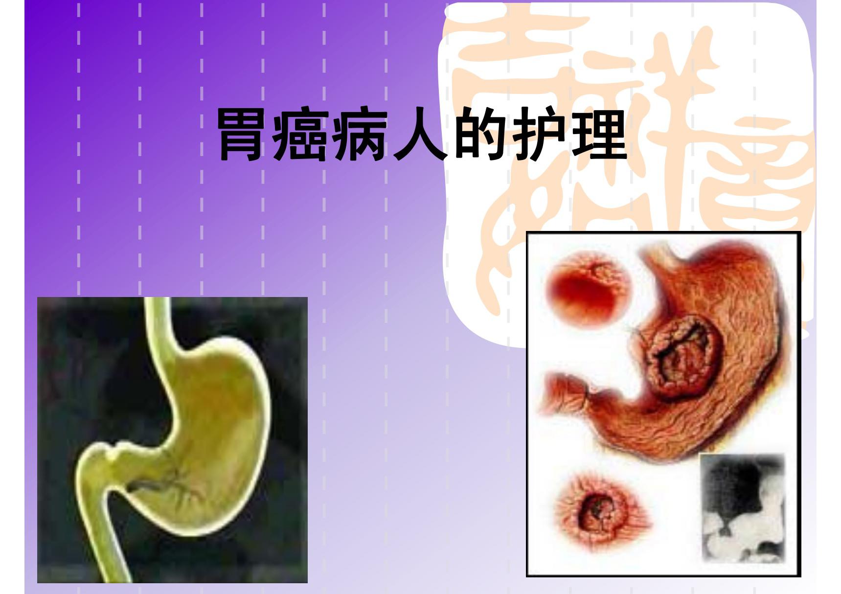 胃癌病人的护理(PPT-精品)