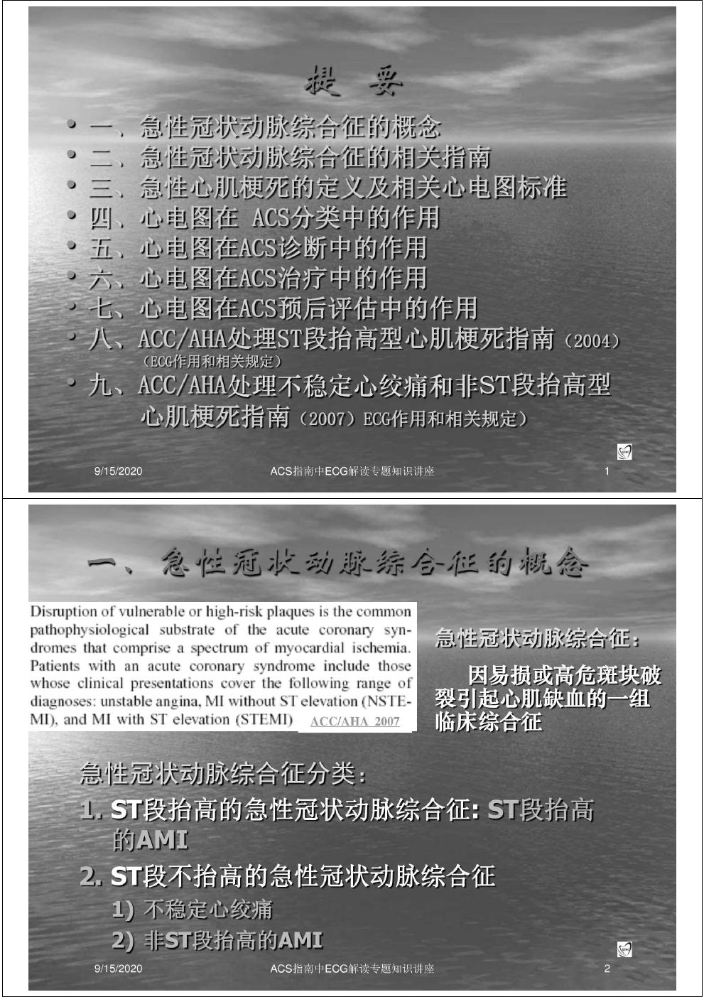 ACS指南中ECG解读专题知识讲座PPT